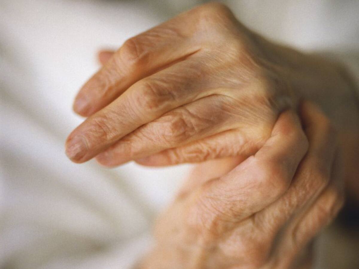 Estos hábitos podrían aumentar riesgo de artritis: consejos para evitarlo