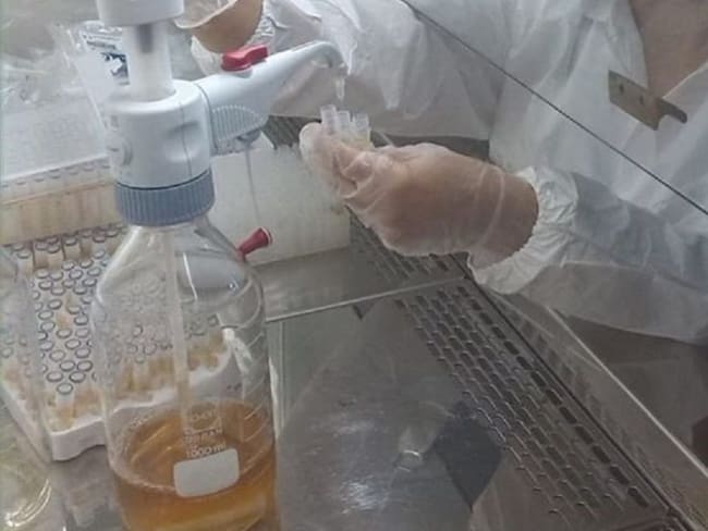 Univalle pone en marcha laboratorio para la toma de muestras de Covid-19