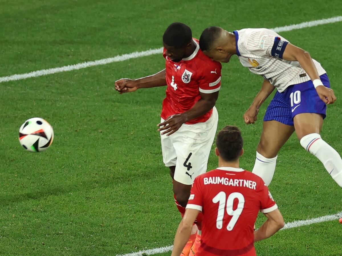 Oficial: Kylian Mbappé no será operado a pesar de sufrir una fractura de nariz ante Austria