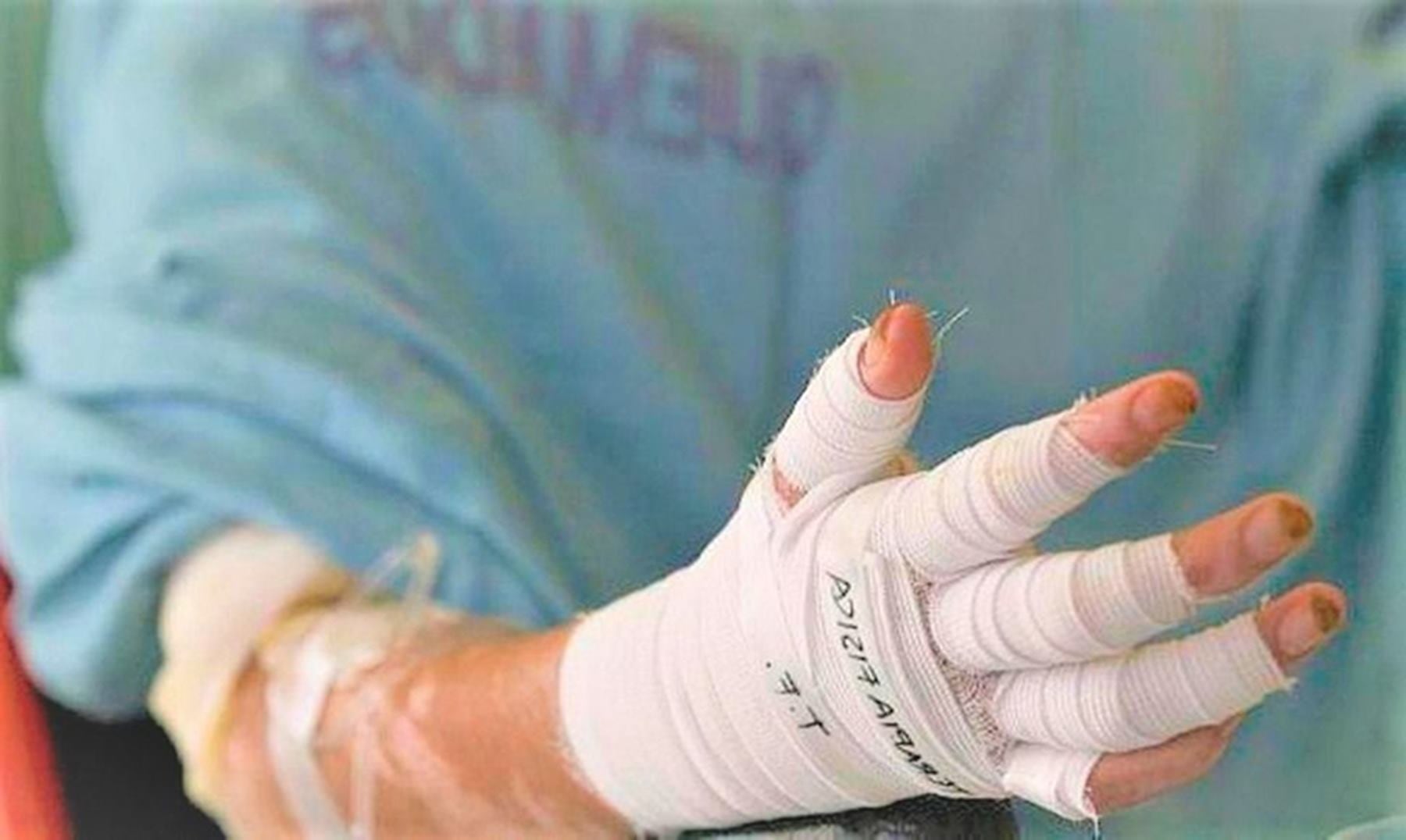 Lesionado con pólvora en Ibagué