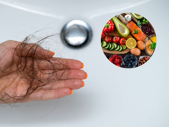 Vitaminas y alimentos para prevenir la caída del cabello - Getty Images