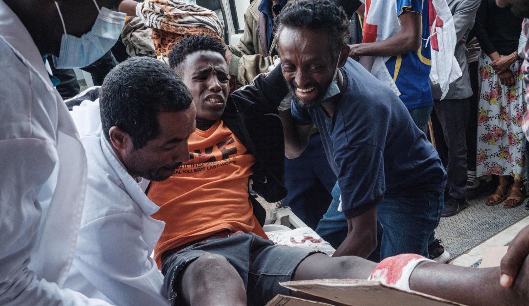 Los combates y bombardeos han dejado cientos de heridos y miles de muertos en Etiopía.
