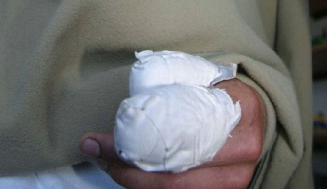 Quemados con pólvora