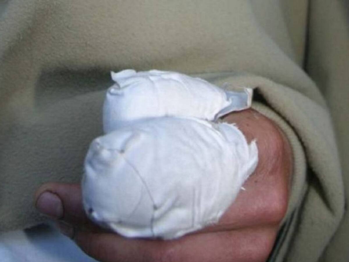 Hasta el momento no se reportan quemados con pólvora en noche de las velitas