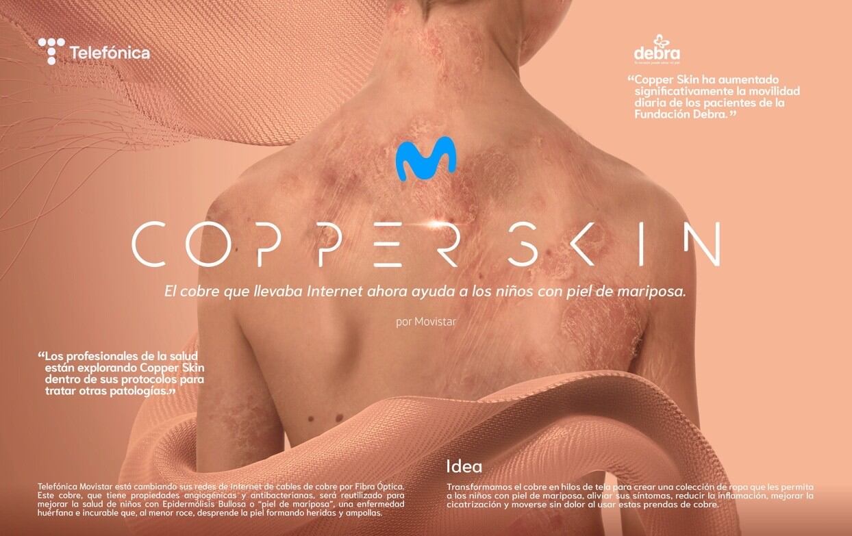 Iniciativa "Copper Skin". Movistar y Fundación Debra Colombia.