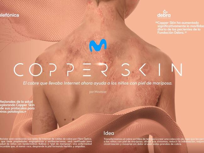 Iniciativa &quot;Copper Skin&quot;. Movistar y Fundación Debra Colombia.