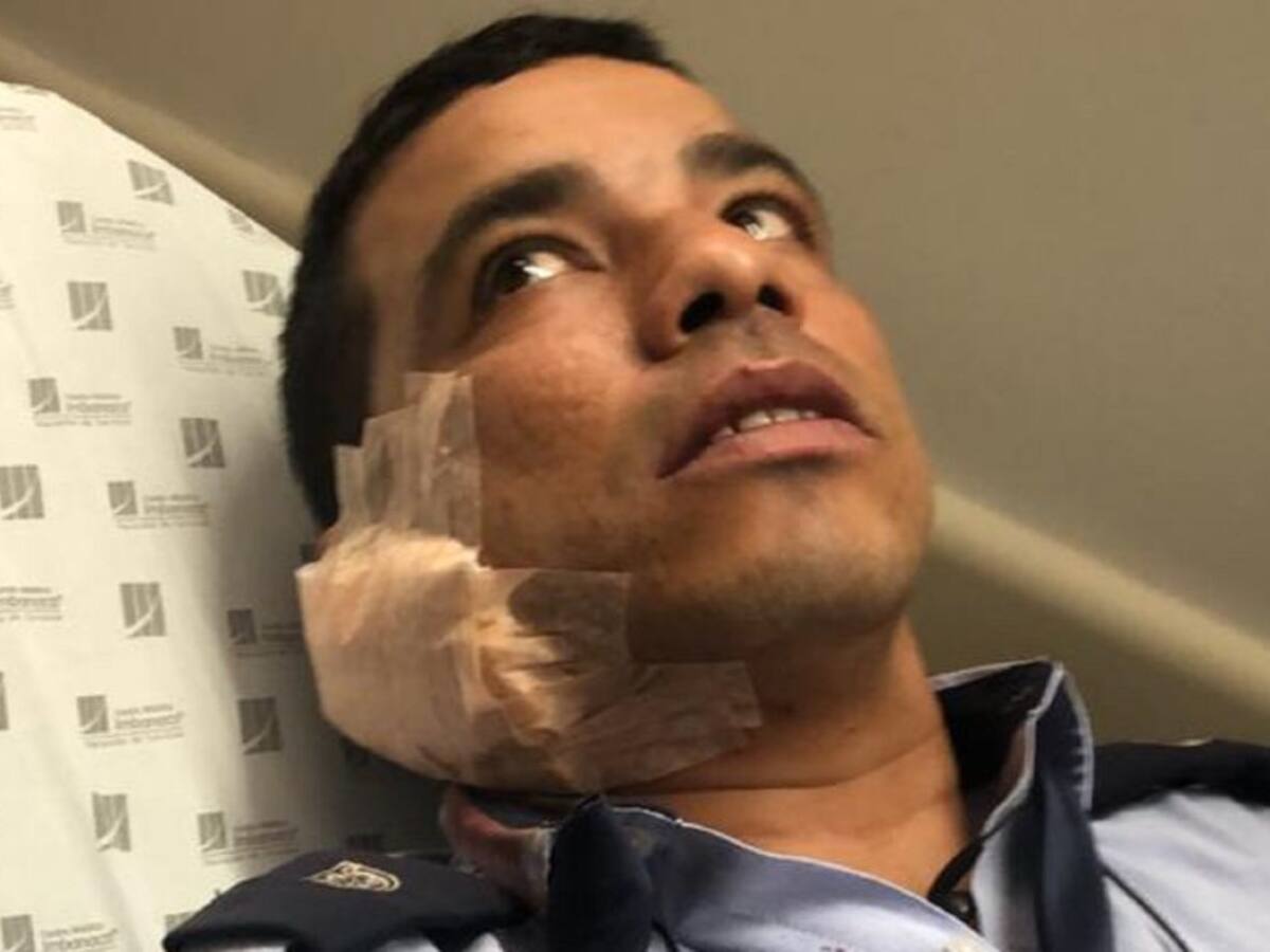 Recompensa de 10 millones de pesos por información del ataque a guarda