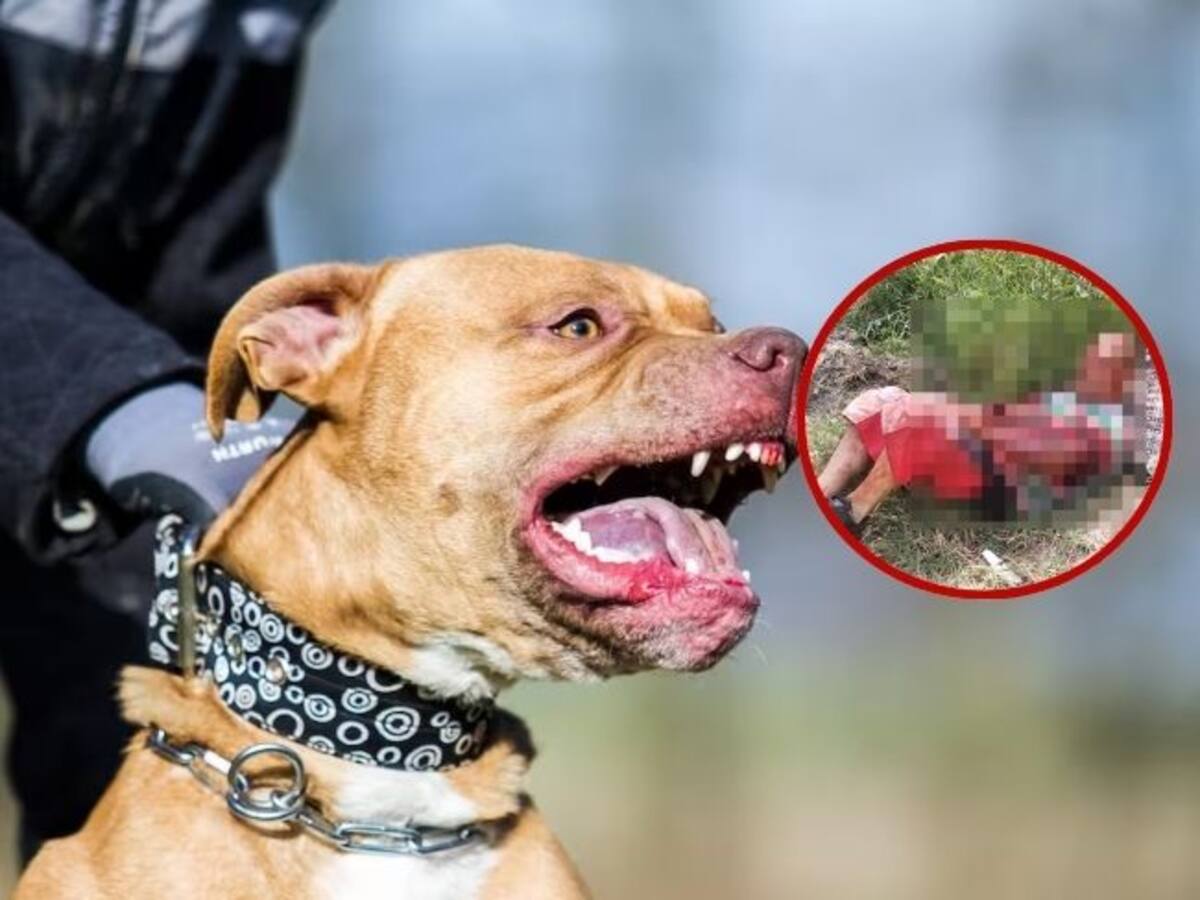 Santander: Campesino por poco muere atacado por un pitbull