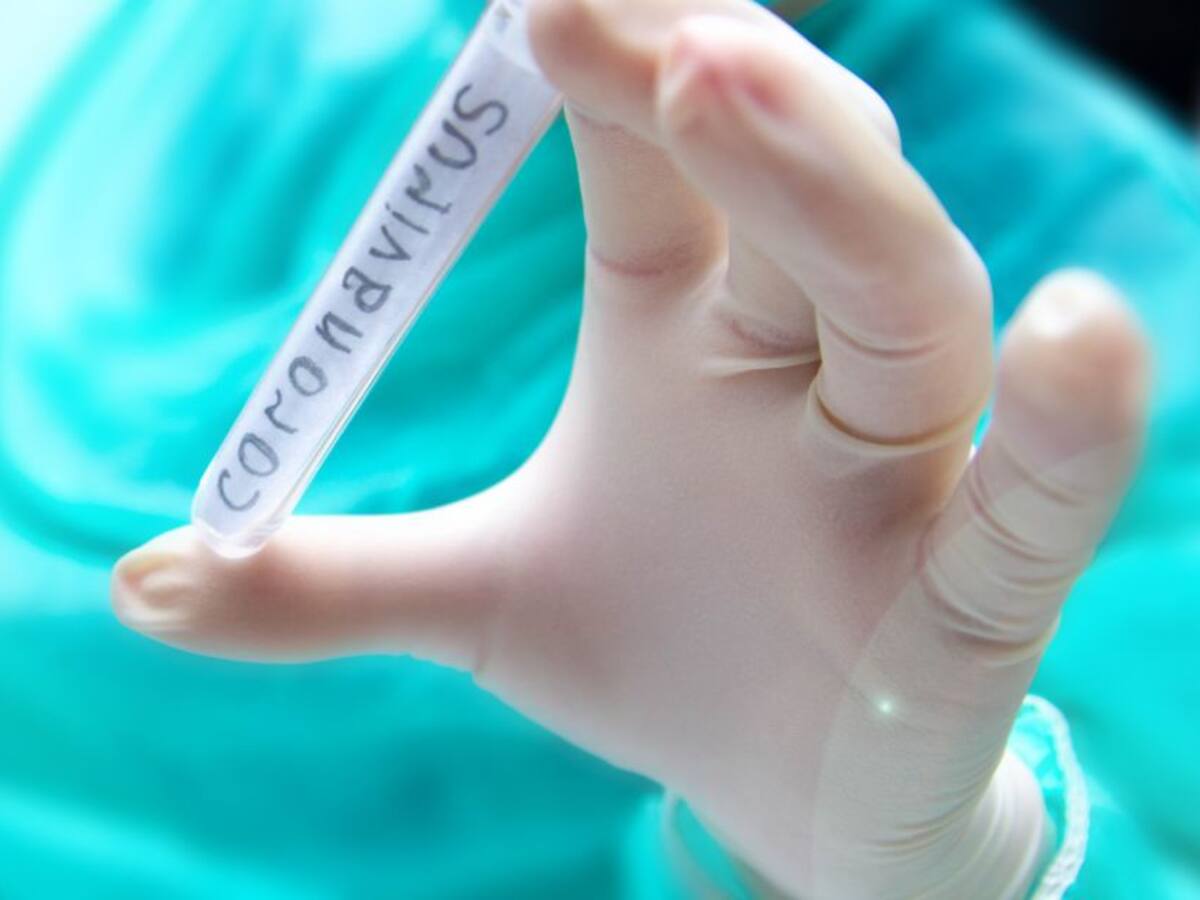 EPS podrán ofrecer entre sus servicios la prueba del Covid-19