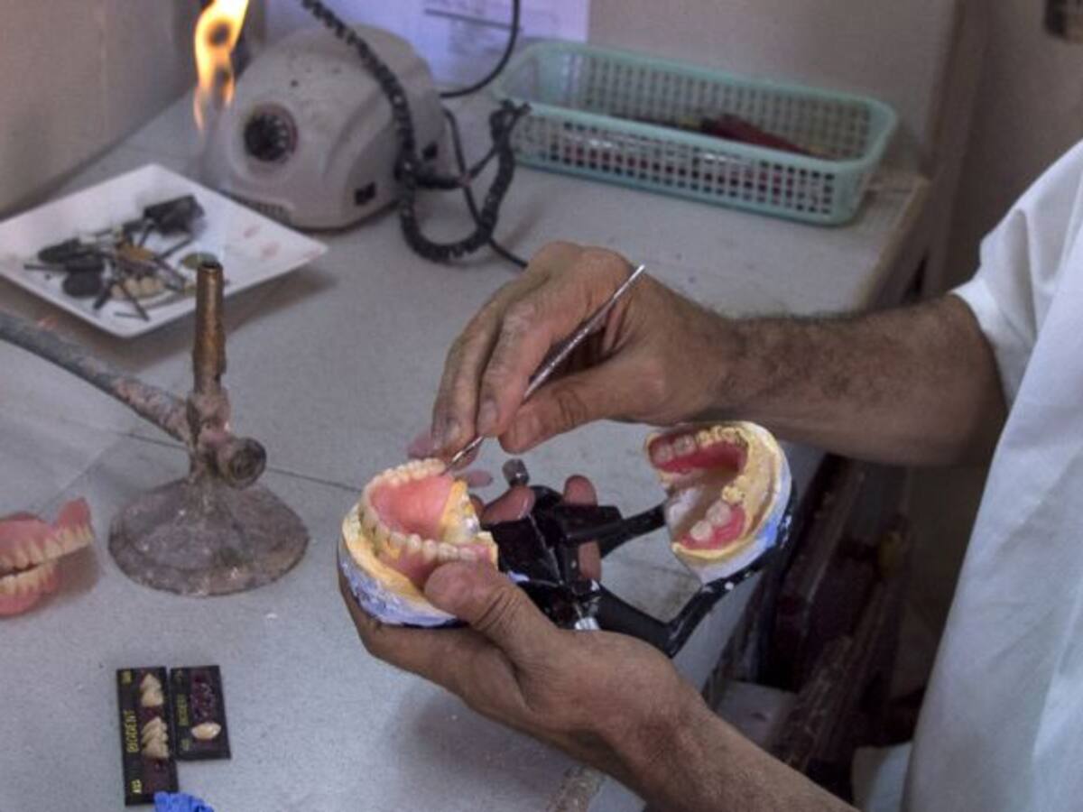 ¿Dientes humanos? Obreros se llevaron tremenda sorpresa