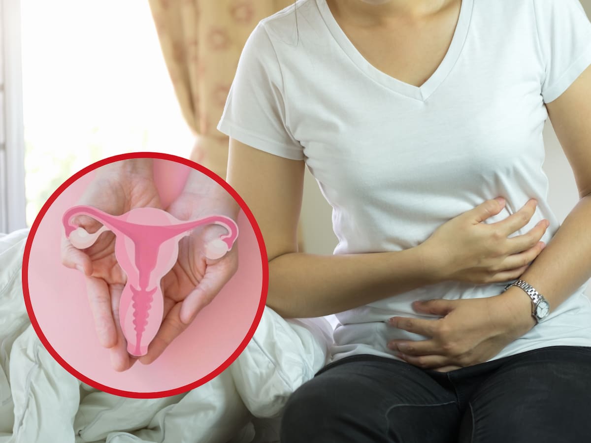 ¿Cómo prevenir el cáncer de ovario? El 70% de los casos se detecta tarde en Colombia