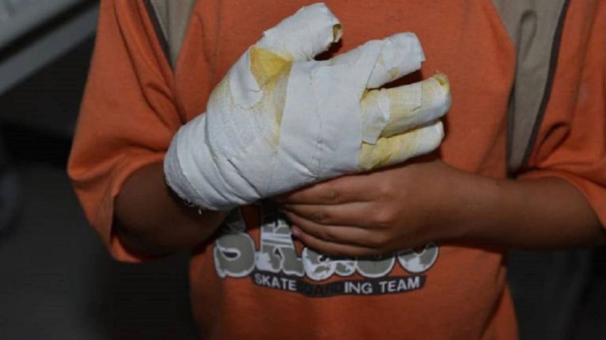 Plan de Vigilancia Intensificada de Manipulación de Pólvora en el Valle