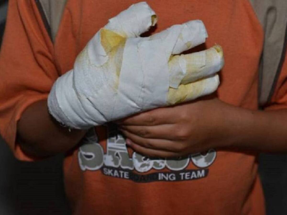 Plan de Vigilancia Intensificada de Manipulación de Pólvora en el Valle