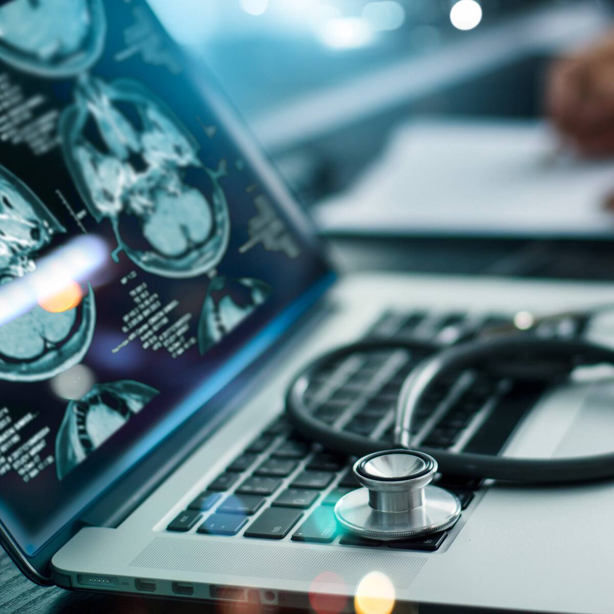 ¿Cuál es el test de los 7 minutos? Así ayuda a la detección del Alzheimer