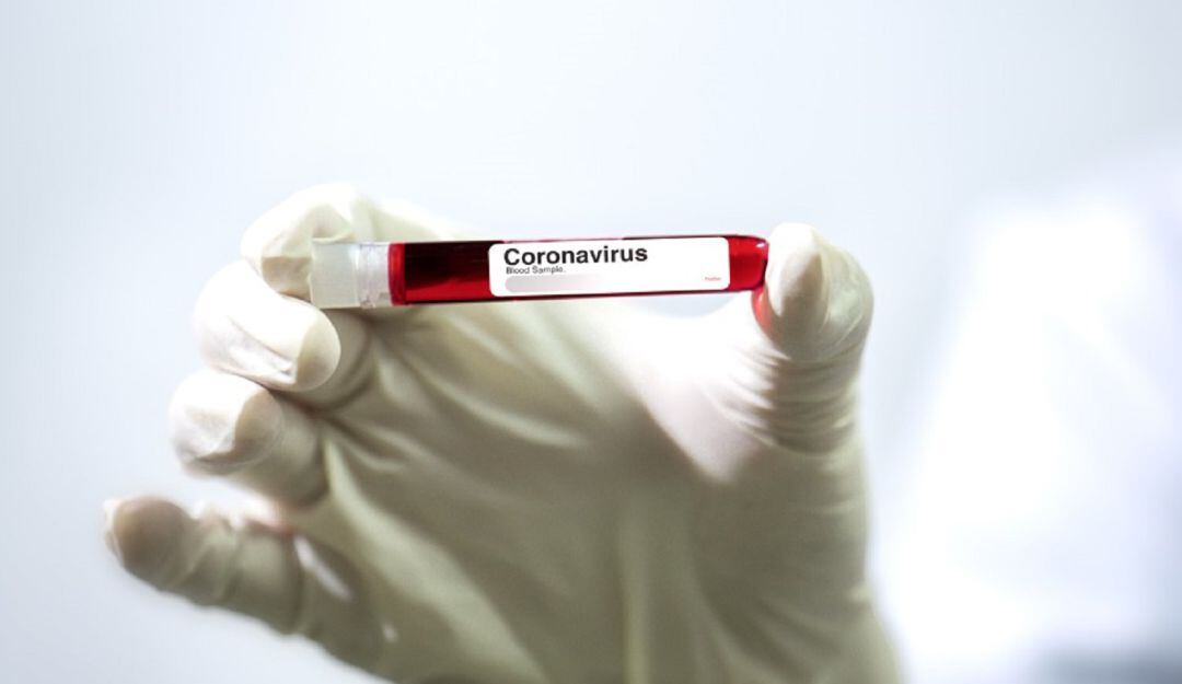 La Secretaria de Salud de Cali solicitó al Ministerio, para que autorice vacunar a las personas que van a salir del país.