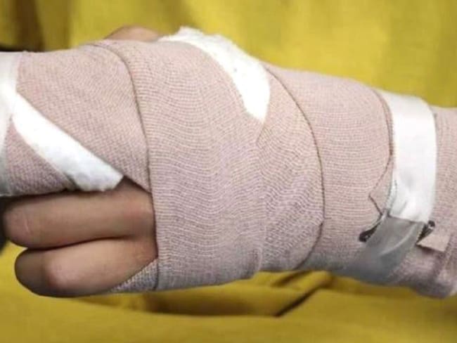 Se registraron dos quemados con pólvora durante la Noche de Velitas en Ibagué