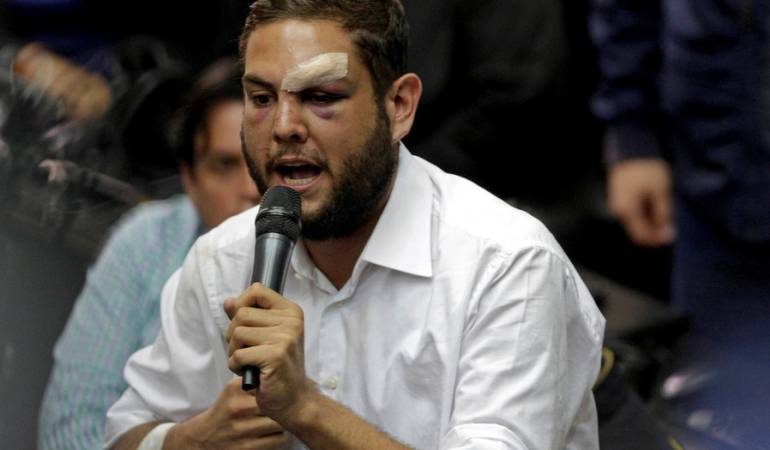 Juan Requesens. Diputado venezolano.