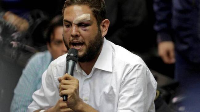 Juan Requesens. Diputado venezolano.