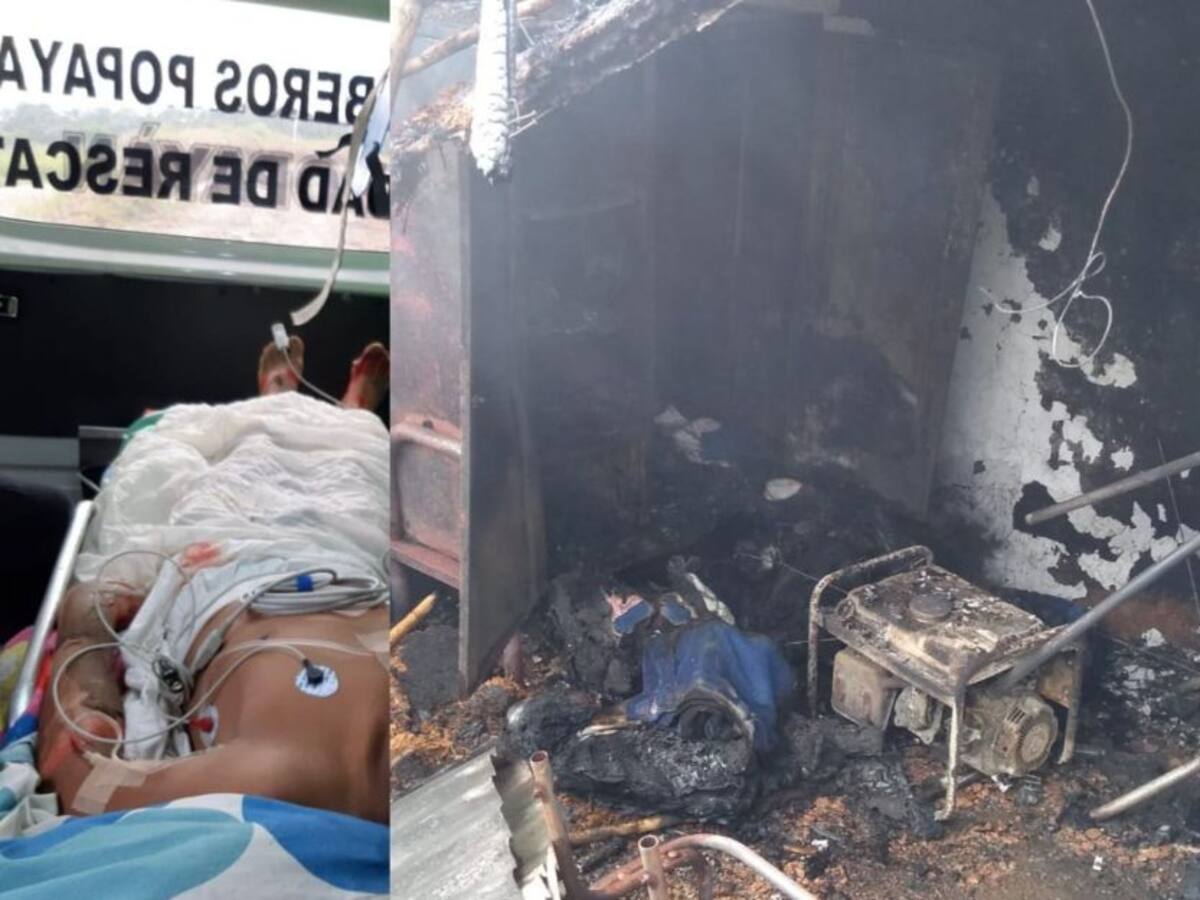 Menor resultó con quemaduras en más del 60% de su cuerpo en un incendio