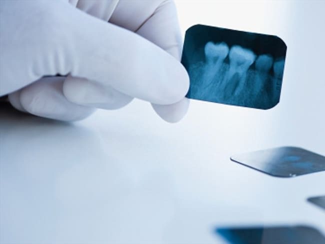 Odontología- Imagen de referencia. Foto: Getty Images