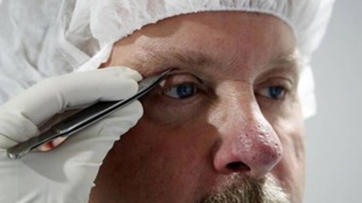 Clínica Barraquer operó gratis a 45 personas de escasos recursos