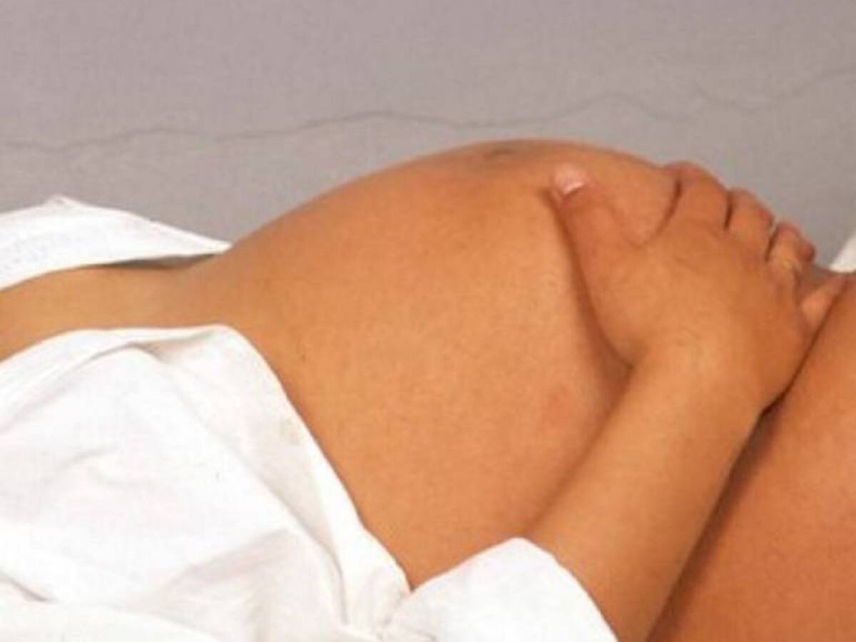 Preocupación en Boyacá por el aumento de casos de mujeres gestantes con el virus del Zika