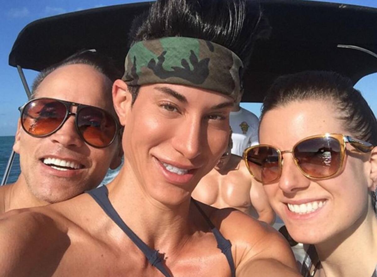 Justin Jedlica se operó para remover tres venas de su frente, intervención que lo pudo dejar ciego. Fotos: Instagram.