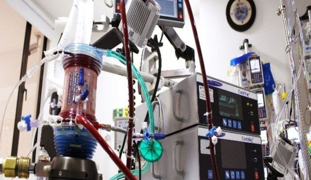 Terapia ECMO.