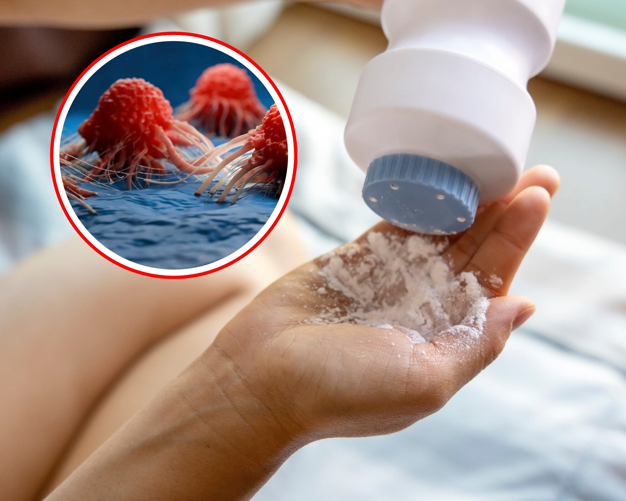 El Centro Internacional de Investigaciones sobre el Cáncer de la Organización Mundial de la Salud vincula el uso de talcos a la aparición de cáncer.
(Foto: Caracol Radio / Getty )