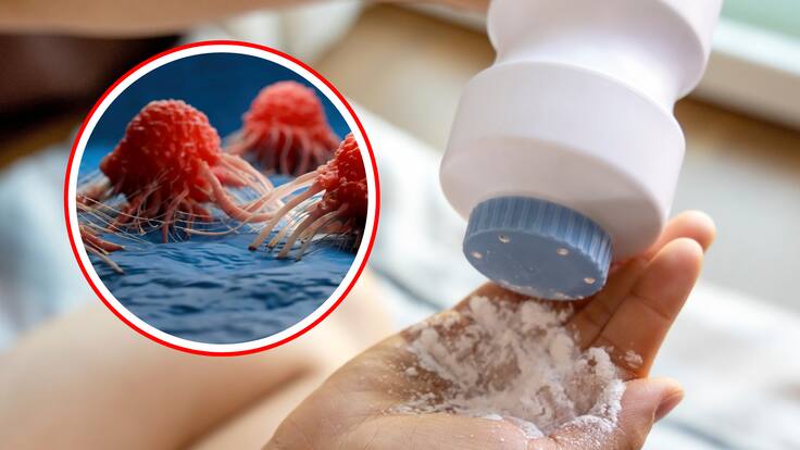 Experto explica por qué la OMS ha declarado al talco como producto “probablemente cancerígeno”