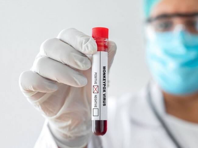 Ana Cecilia López, epidemióloga de la secretaria de salud del Quindío