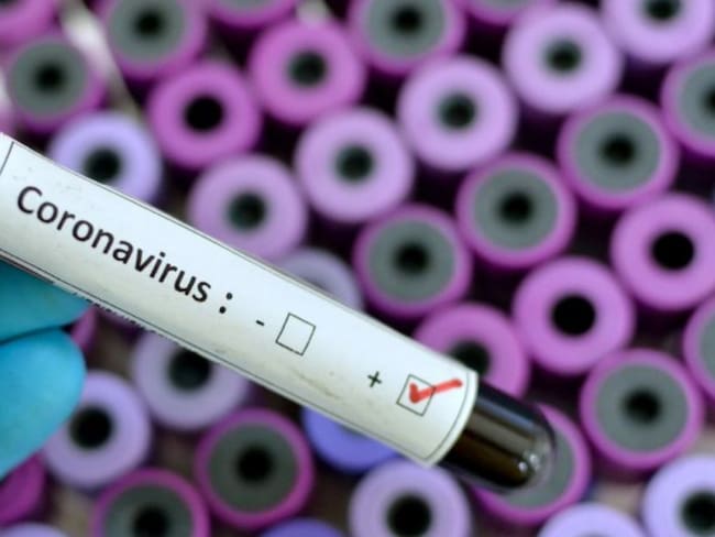 MinSalud confirma primer caso de coronavirus en Puerto Colombia, Atlántico