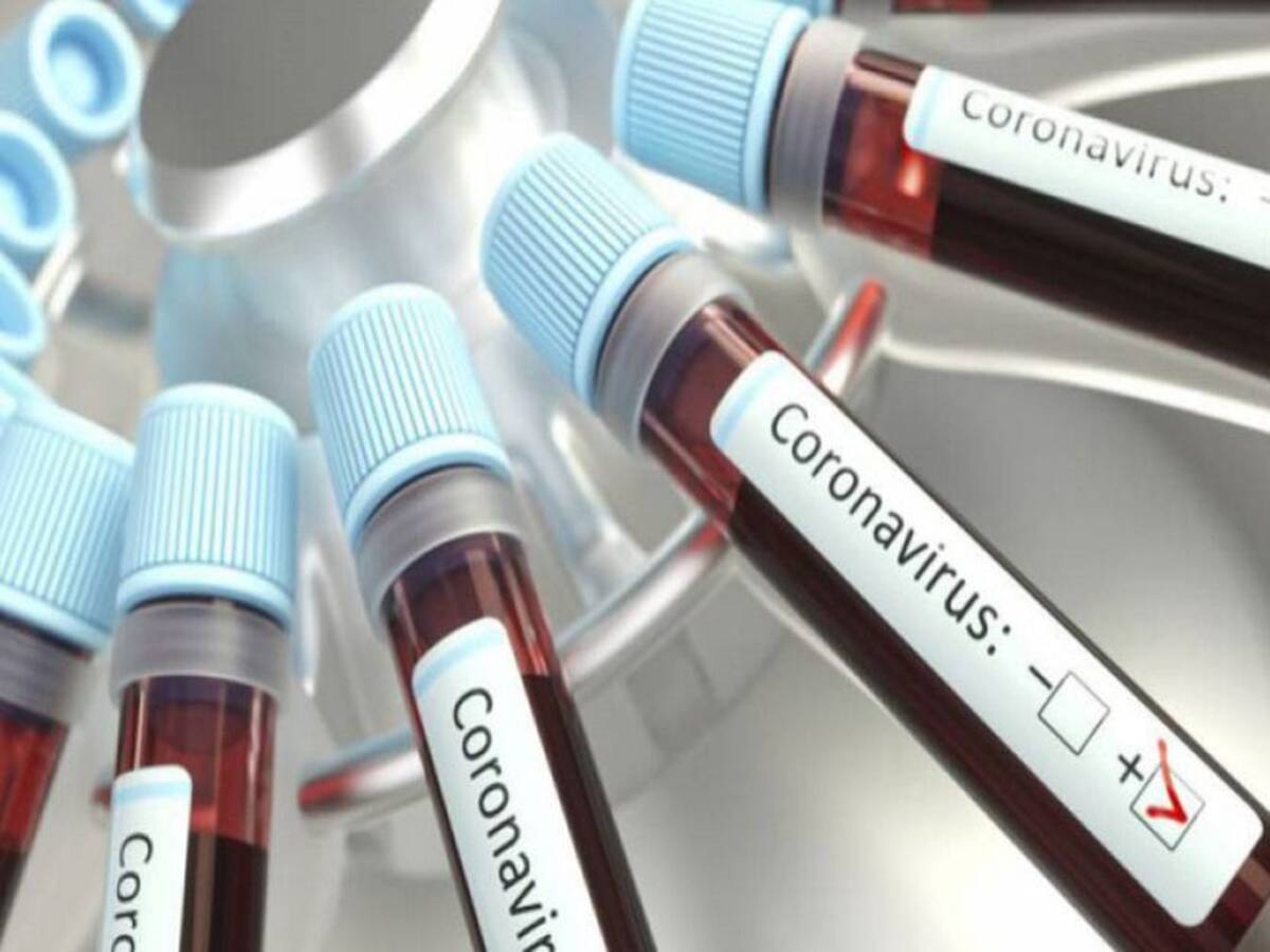 Cifra récord de infectados en Atlántico con 2.563 con COVID-19 este jueves