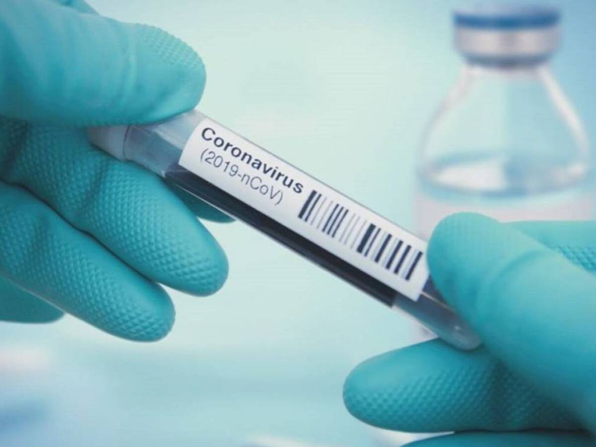 Reportan 30 nuevos casos y un fallecido por coronavirus en Sucre