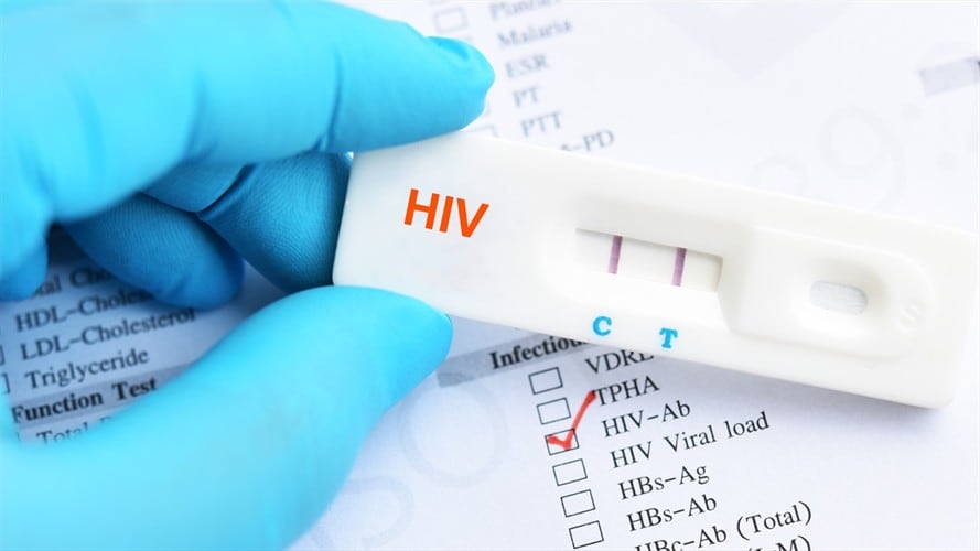 Paciente vih positivo /Foto: Getty Images