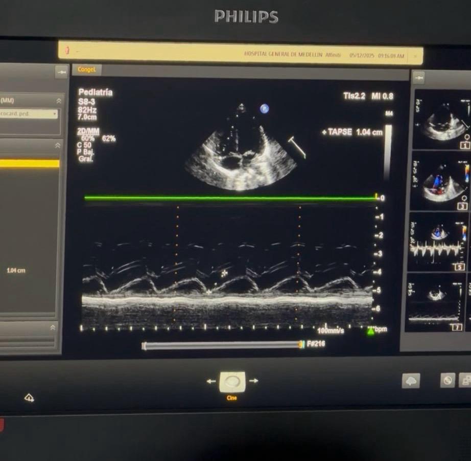 Foto: Caracol Radio.