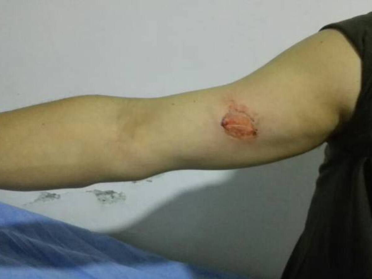 Ciudadanos alicorados atacaron a mordiscos a los policias