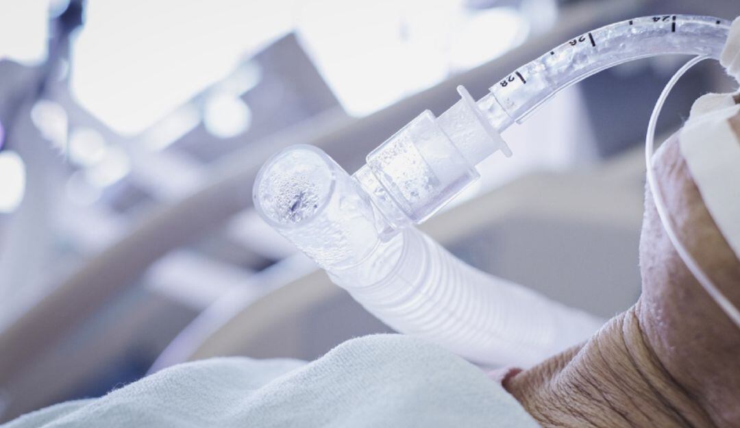 A hoy en el Valle 96 personas están con COVID-19 en unidad de cuidados intensivos con un ventilador conectado.