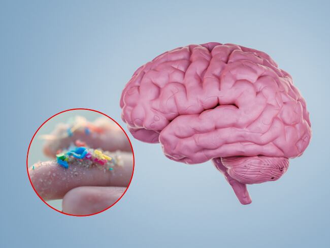 Cerebro, microplásticos, imágenes de referencia (Getty Images).