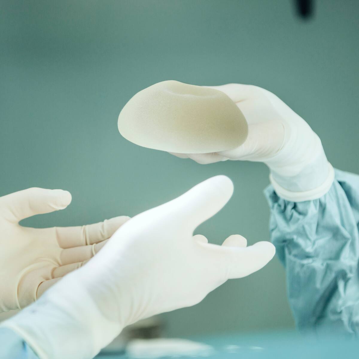 Síndrome de Asia: ¿las mujeres deben retirarse los implantes de silicona?