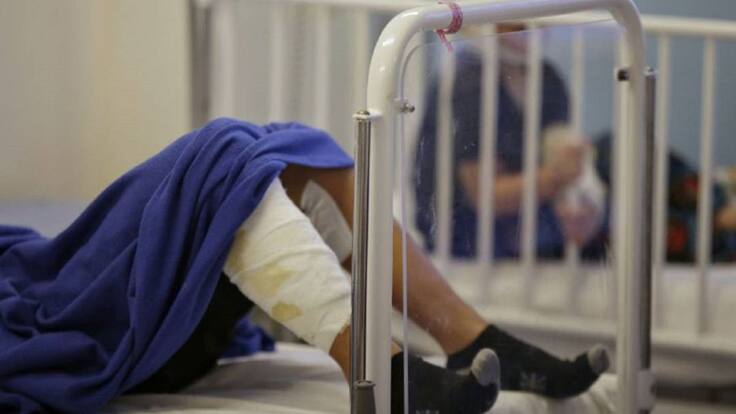 Segunda persona quemada por pólvora en época decembrina