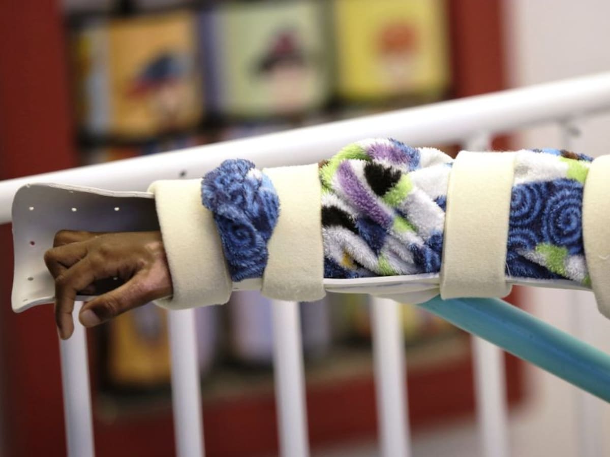 Mujer quemada con pólvora en Cartagena en celebración de Velitas