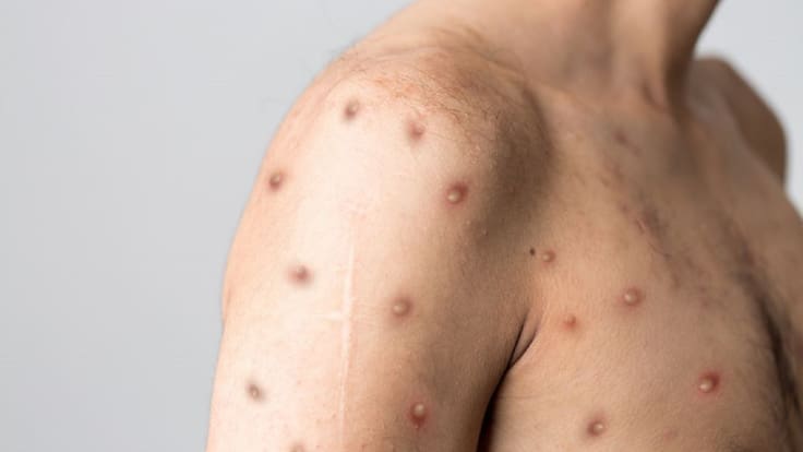 Jorge Zapata, secretario (e) de Salud del Quindío