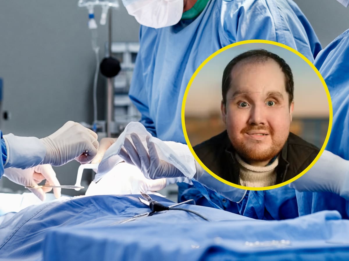 Clínica Mayo logró exitoso trasplante facial: ¿Cómo fue este procedimiento? Doctor explica