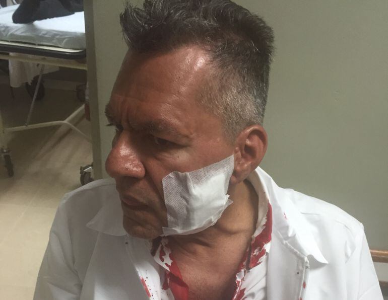 Gerente IPS Universitaria,Juan Edgar Marín, herido en el rostro.