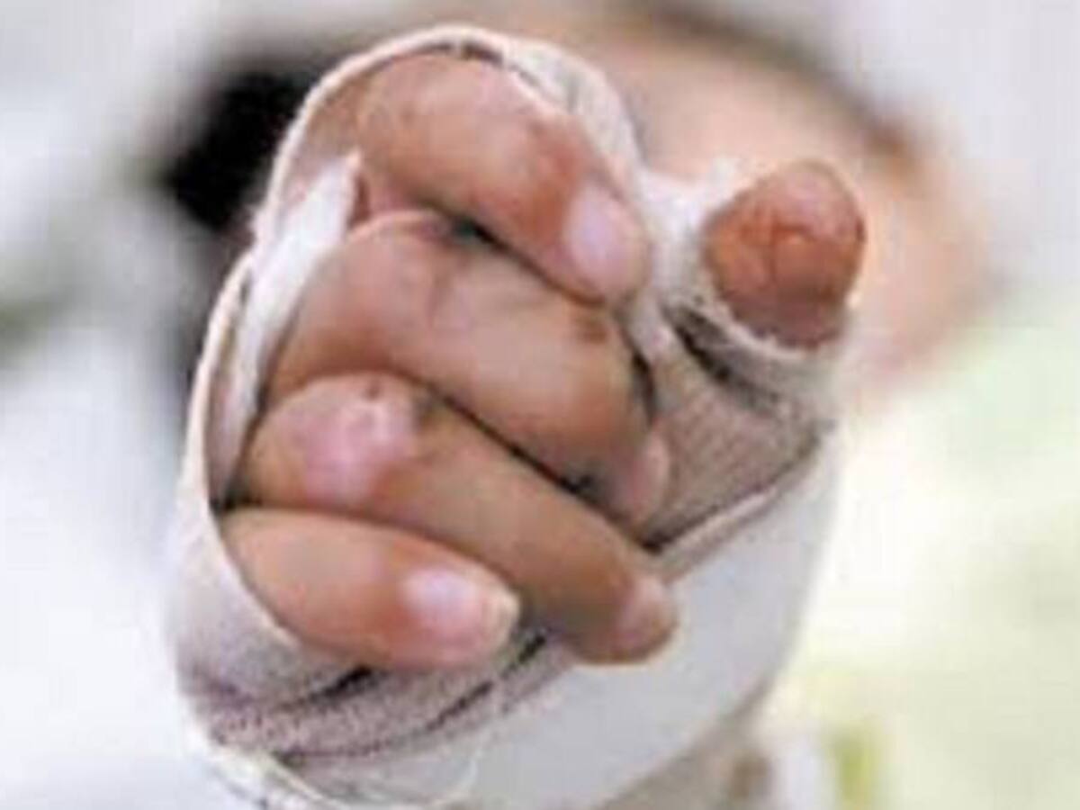 A 46 asciende los quemados con pólvora en el Valle