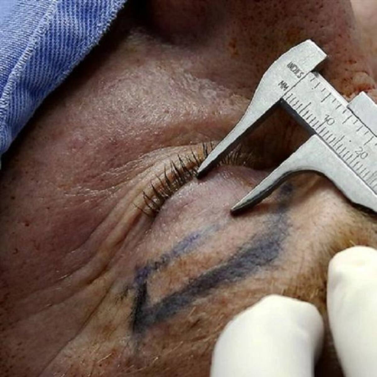 Cirugías estéticas que marcaron tendencia este 2021