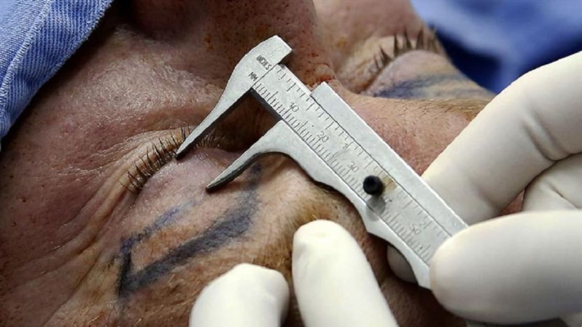 “No encontramos nada que indicara que allí funcionaba un centro estético”: Secretaría de Salud