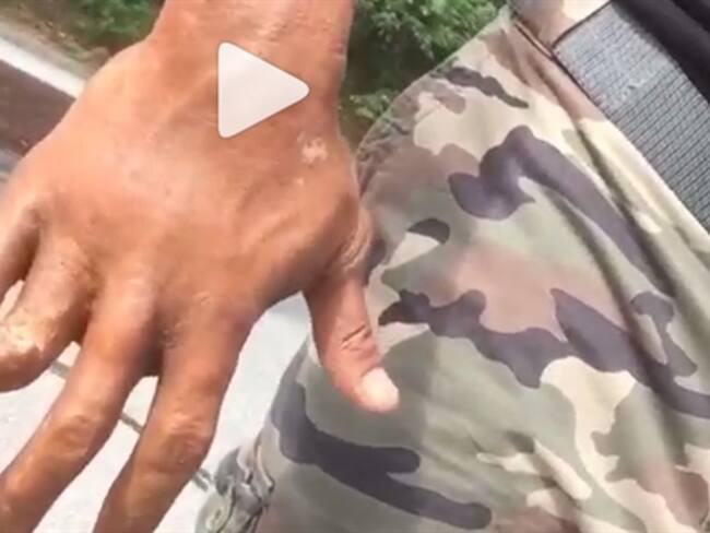 The Rock comparte su último accidente en video de Instagram