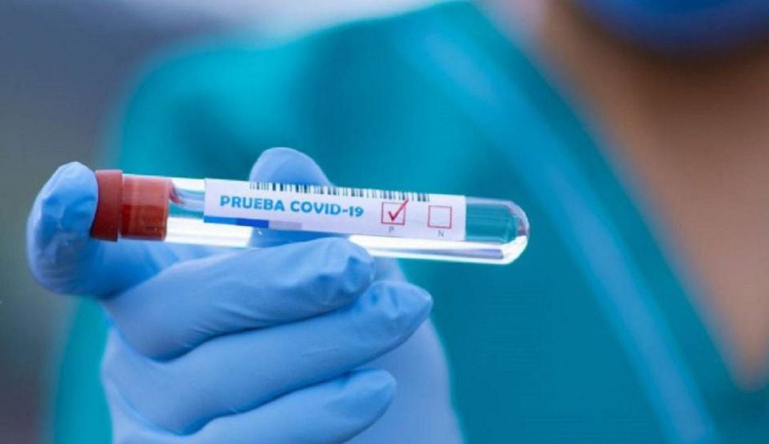 Cali registra al 25 de julio 255.535 casos positivos y 6.679 fallecidos por COVID-19.